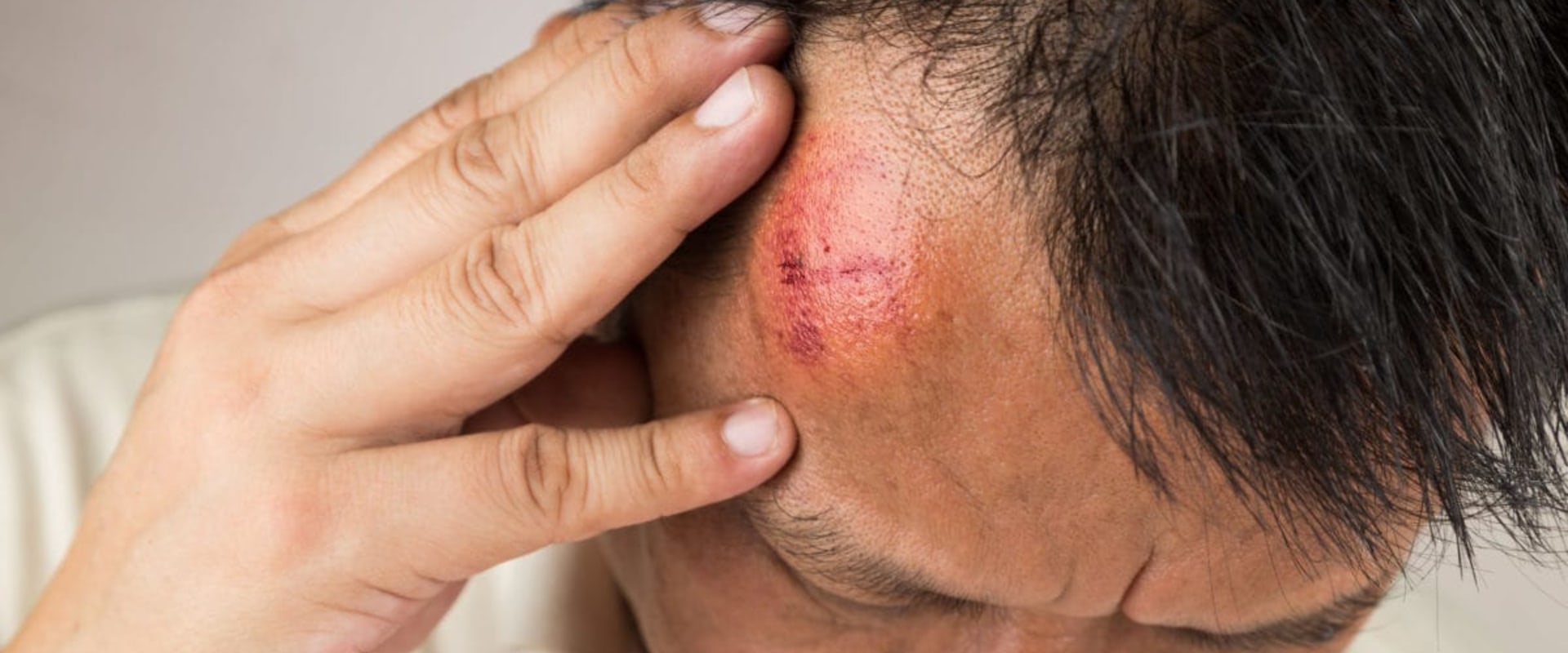 Can A Head Injury Affect You Weeks Later