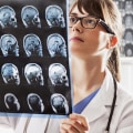 What is the best medicine for traumatic brain injury?