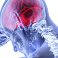 What are the 3 types of brain injuries?