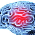 Treatment of traumatic brain injury?