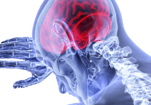 What are the 3 types of brain injuries?